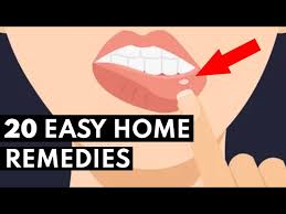 how to get rid of canker sores fast