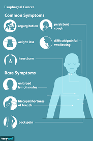 esophageal cancer signs and symptoms