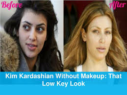 ppt celebrity plastic surgery before