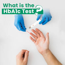 what is the hba1c test vitrosens
