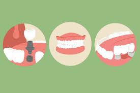 missing teeth causes impact treatment