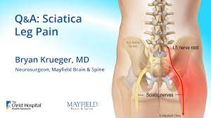 sciatica shooting leg pain