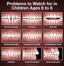 This can be done by moving teeth into proper alignment. Orthodontics In Rochester Fairport Ny Kazley Orthodontics