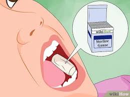 Pieces of ice are another way you can try to relieve wisdom pain yourself, especially if one or more are coming through and there's no apparent problem, just some pain and discomfort associated with this final stage of your dental development. 3 Ways To Ease Wisdom Tooth Pain Wikihow