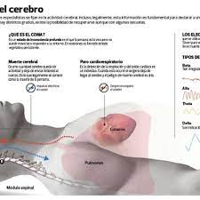 El neurólogo y pediatra dr. Hay Que Distinguir Entre El Estado De Coma Y La Muerte Cerebral Tecnologia El Comercio Peru