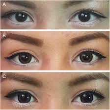 I would like to purchase cosmetic contact lens sell in by the way, also hope korea and japan hope sellers out there can me as soon possible thankyou! A Review Of Cosmetic Contact Lens Infections Eye