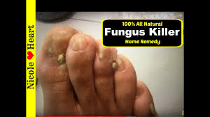 toenail fungus athlete s foot