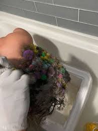 child gets 150 bunchems stuck in hair