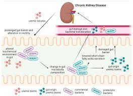 Toxins | Free Full-Text | Gut&ndash;Kidney Axis Investigations in Animal  Models of Chronic Kidney Disease