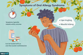 apple allergy symptoms causes foods