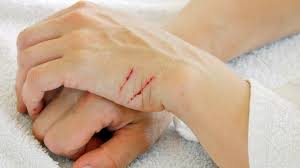 how to treat cat scratches at home petmd
