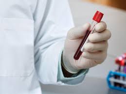This test is a basic blood draw and takes just a few minutes. The Elf Blood Test