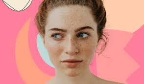 home remes for freckles on the face