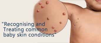 common baby skin conditions