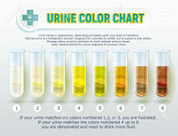 Illustration Of A Visual Poster Urine Color Chart