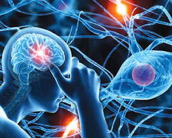 Image of Neurological disorders