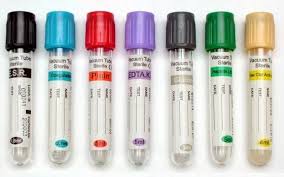 Common Blood Collection Tubes Their Additives And