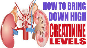 How To Bring Down Or Reduce High Creatinine Levels Prevent