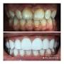 Ilham Dental Clinic Dubai from m.facebook.com