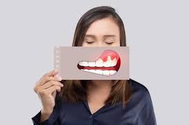 tooth gum swelling and treatment