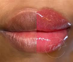 dark lips training facetuningstudio