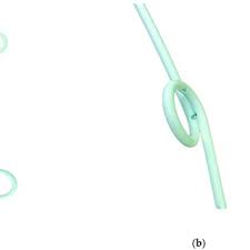 double loop pigtail catheter