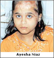 LAHORE, Aug 7: Ayesha Niaz (11), a survivor of the last year&#39;s Mughalpura ... - nat04