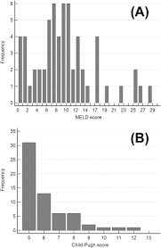 Impact Of Meld Score And Cardiopulmonary Bypass Duration On