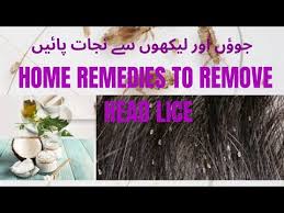 remes to remove lice