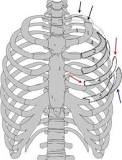Image result for icd 10 code for flail chest