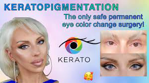 i changed my eye color at keratonyc