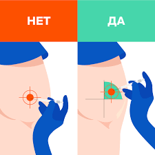Как сделать укол правильно: внутримышечно в ягодицу, укол самому себе в ногу