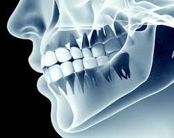 cbct for dental implants in houston