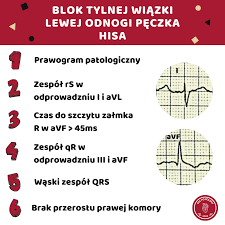 EKG po polsku - ❓Jak rozpoznać blok tylnej wiązki lewej... | Facebook