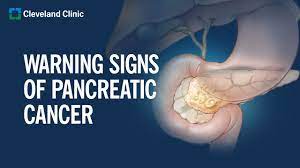 pancreatic cancer symptoms causes