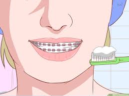 how to heal sore lips 13 steps with