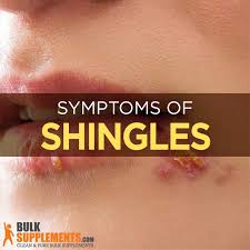 shingles enpox causes