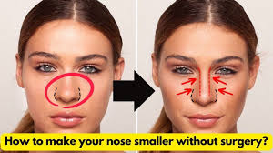 your nose smaller without surgery