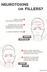 Great Diagram To Work Out Whether You Need Botox Dysport