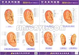 Series Chart Of Acupuncture Ear Needle Series Chart Of