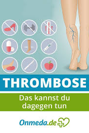 Thrombosis) die thrombose ist eine gefäßerkrankung, bei der es zu einem vollständigen oder teilweisen verschluss von gefäßen durch. Thrombose Blutgerinnsel Symptome Behandlung Vorbeugen Onmeda De Blutgerinnsel Behandlung Krankheit