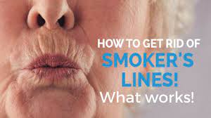 how to remove smoker s lines update