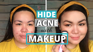 makeup for acne e skin sace lady