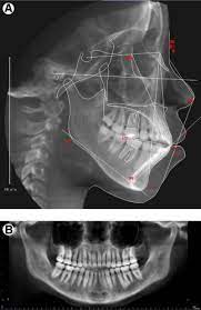 cone beam computed tomography