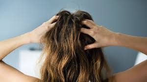 best home remes for scalp psoriasis