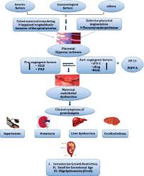 Flow Diagram Showing Process Of Pathogenesis Of Pre Ecl Open I