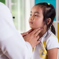 swollen lymph nodes in children the