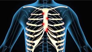 Chiropractors at the joint may be able to help relieve the symptoms of costochondritis by adjusting subluxations, or dysfunctions, in the joints that connect the ribs to the spine. What S Causing Your Chest Pain And Swelling
