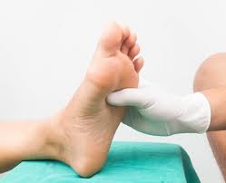 Image result for diabetic neuropathy