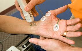Image result for Diabetic neuropathy diagnosis pictures